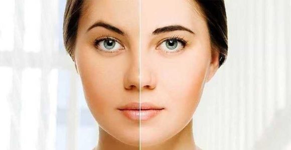6 راه خانگی برای سفید شدن پوست صورت