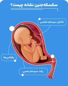 سکسکه جنین چه علتی دارد؟