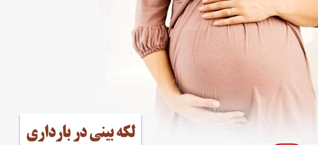 لکه بینی در بارداری ماه اول چقدر طول می‌کشد؟