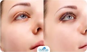 فواید استفاده از تقویت کننده مژه در بارداری